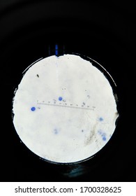 Plasmodium Vivax In Slide Thin Film