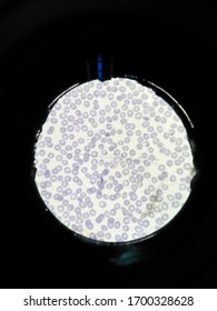 Plasmodium Vivax In Slide Thin Film