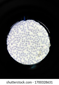 Plasmodium Vivax In Slide Thin Film