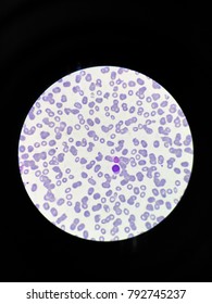 Plasmodium Vivax In Thin Film