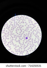 Plasmodium Images, Stock Photos & Vectors | Shutterstock