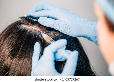 Plasmolifting Scalp Case Initial Stages Baldness Stock Photo 1405727267 ...