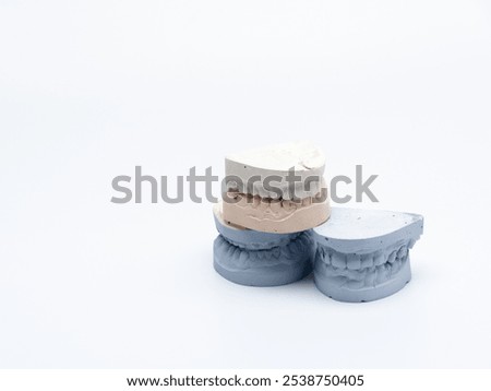 Plaster casts prototypes of dentures on a light background