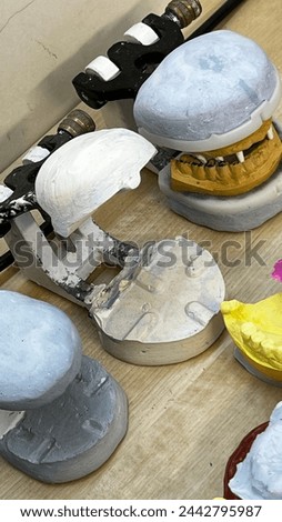 Plaster dental models read to be loaded with new smile designs.