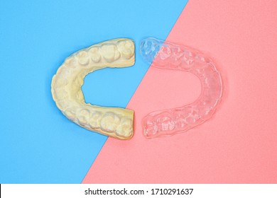 Plaster Impression Of Teeth. Dental Plaster Mold And Orthodontic Silicone Trainer. Mobile Orthodontic Appliance For Dental Correction, On Blue And Pink Background. Tooth Whitening Systems . 