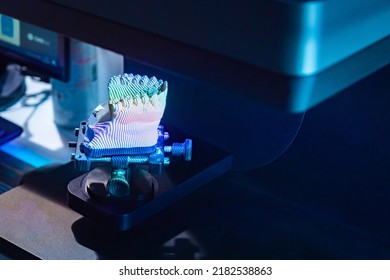 Plaster model of the prosthesis. Dental prosthetics. Orthodontics and dental treatment. A dental prosthesis. A model of the jaw in striped lighting. Production of dentures. Model of the human jaw. - Powered by Shutterstock