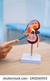 Plastic Bladder In The Doctor's Office. Visual Material Of Kidney For The Urologist. Blurred Background.