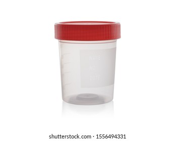 Plastic container for medical tests with reflection. Isolated on white background