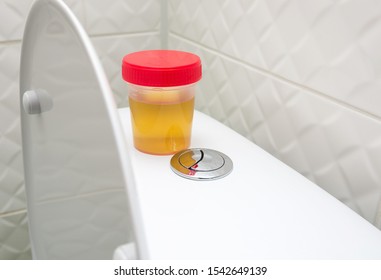 Plastic Disposable Drug Or Doping Testing Container With Human Urine For Laboratory. Urine Sample Cup, Medical Test In Hospital.