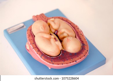 Plastic Mock-up Of A Human Embryo For Students Of A Medical College. Twins