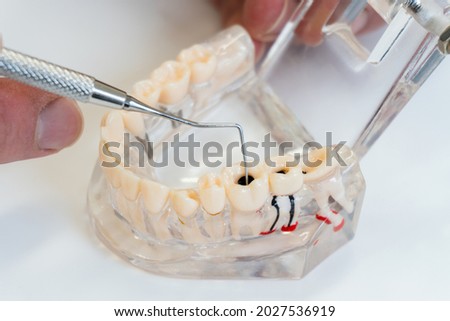 plastic model of a human jaw.  Dentist demonstrates problems with teeth. Oral dental hygiene concept. Dental dentistry students teaching model showing teeth, roots, gums, gum disease, caries 