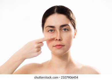 Plastic nose surgery. Portrait of young caucasian woman point her crooked bridge of the nose isolated on white background. Copy space. Concept of rhinoplasty.