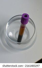 Plastic Purple Top EDTA Vacutainer Holding Whole Blood In A Glass