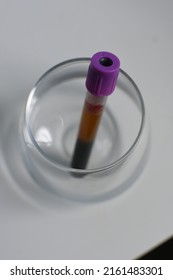 Plastic Purple Top EDTA Vacutainer Holding Whole Blood In A Glass