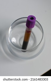 Plastic Purple Top EDTA Vacutainer Holding Whole Blood In A Glass