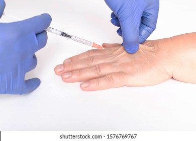 A Plastic Surgeon Doctor Does An Injection Of A Beauty Injection Into The Hands Of An Elderly Woman. Hand Wrinkle Rejuvenation Concept, Close-up. Lipofilling