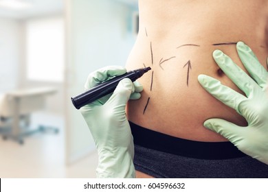 plastic surgeon marking womans body for surgery - Shutterstock ID 604596632