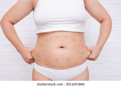 a plastic surgeon marks a woman's body for surgery to correct the figure. - Shutterstock ID 2011691846