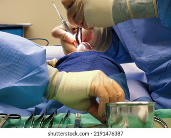 A Plastic Surgeon Performing A Rhinoplasty Procedure In The Background While The Surgical Technician Reaches For The Next Surgical Instrument In The Foreground.