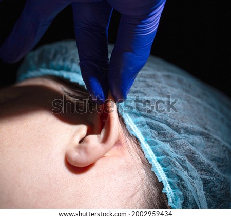 A plastic surgeon performs an operation to correct the ears of a female patient. Otoplasty, elimination of protruding ears, plastic surgery
