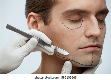 Plastic Surgery. Closeup Of Handsome Young Man With Black Lines On Facial Skin And Surgeon Hand With Scalpel Near Cutting Lines On Attractive Male Face Before Skin Lifting Operation. High Resolution