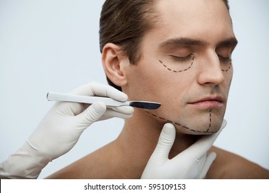 Plastic Surgery. Closeup Of Handsome Young Man With Black Lines On Facial Skin And Surgeon Hand With Scalpel Near Cutting Lines On Attractive Male Face Before Skin Lifting Operation. High Resolution