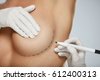 breast plastic surgery