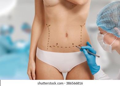 Plastic Surgery Doctor Draw Line On Patient Breast Augmentation Implant. Woman Belly Marked Out For Cosmetic Surgery In Surgery Room Interior