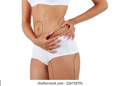 Plastic surgery. Liposuction. Slim body concept