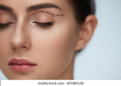 Plastic Surgery Operation. Closeup Beautiful Young Woman Face With Fresh Skin And Perfect Makeup On White Background. Female Face With Black Surgical Lines On Eyelids. High Resolution