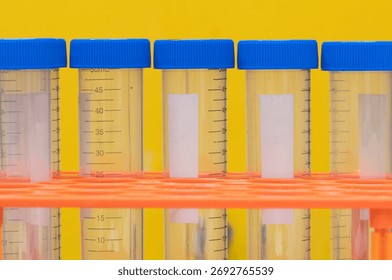 Plastic test tubes empty bottle vials milliliter measurement with caps on yellow background.