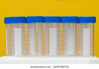 Plastic test tubes empty bottle vials milliliter measurement with caps on yellow background.