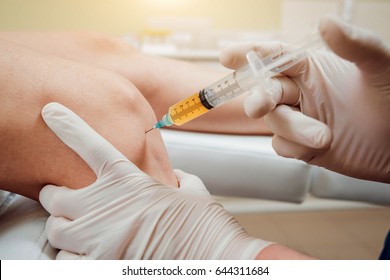 Platelet-rich plasma injection of the knee