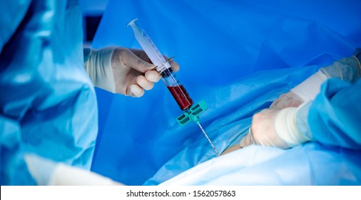 Platelet-Rich plasma preparation. Plasma in syringe. Modern equipment in operating room.