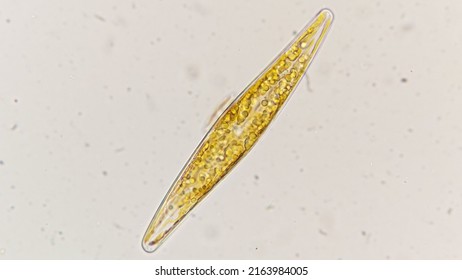 Pleurosigma Sp, An Elongated Diamond-shaped Marine Diatom. 400x Magnification