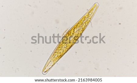 Pleurosigma sp, an elongated diamond-shaped marine diatom. 400x magnification