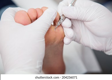 podiatrist ( chiropodist ) cleaning woman feet ( toenails )
