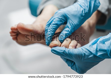 Podiatrist treating feet during procedure Zdjęcia stock © 