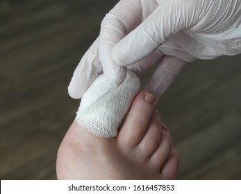 Podiatry Chiropody Foot Medical Stubbed Toe