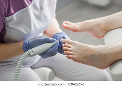 Podiatry doctor. Treatment of feet and nails.