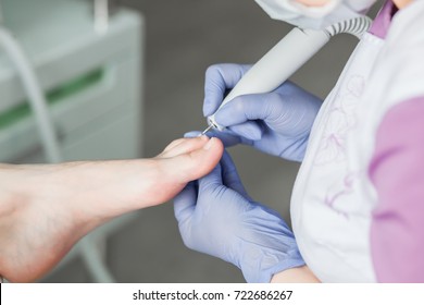 Podiatry doctor. Treatment of feet and nails.