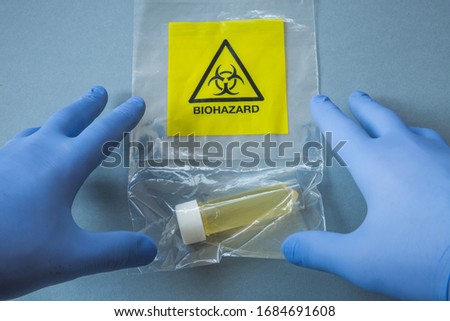 A point of view image of a pair of hands in blue protective gloves working with a Biohazard virus such as Coronavirus in a Laboratory