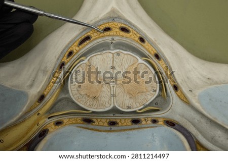 Pointer Showing Epidural Space In Cervical Spinal Cord Model