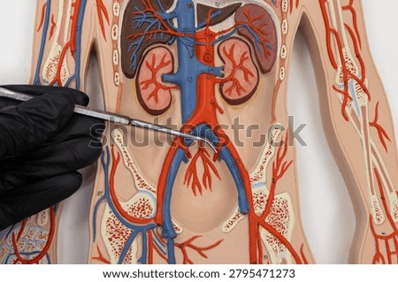 Pointer Showing The Internal Iliac Artery On Human Anatomy Model