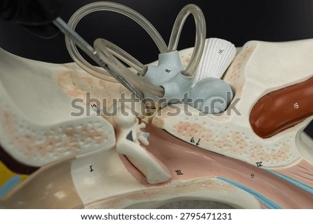 Pointer Showing The Stapes Stirrup On Ear Anatomy Model