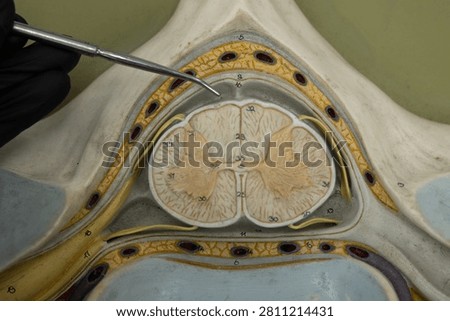 Pointer Showing Subarachnoid Space In Cervical Spinal Cord Model