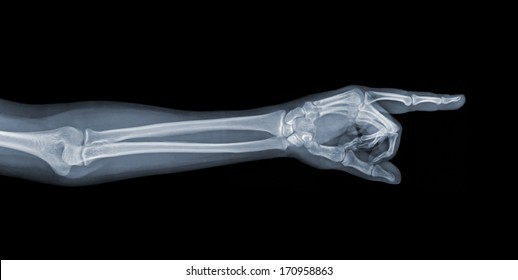 Xray Hand Images Stock Photos Vectors Shutterstock