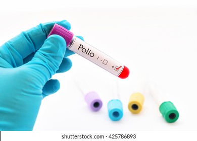 Polio Virus Positive Blood Sample