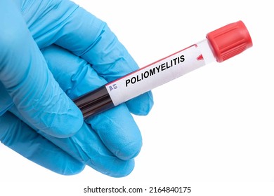 Poliomyelitis. Poliomyelitis Disease Blood Test In Doctor Hand