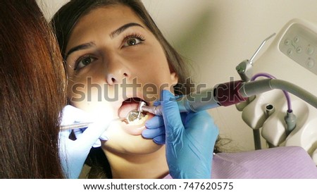 Polishing Inlays at Dentist Office close-up 4K video